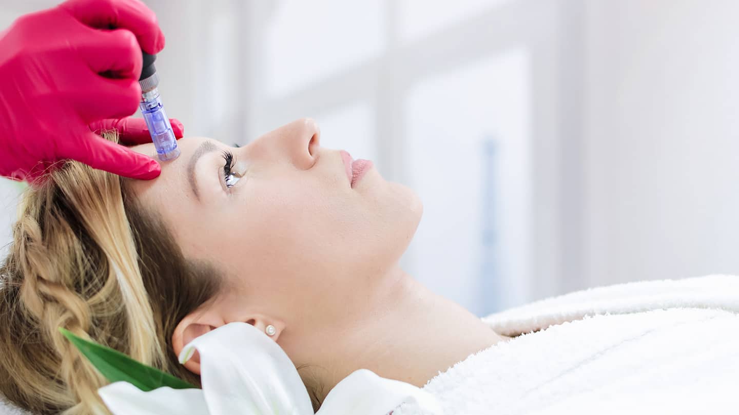Mikrodermaabrasion und Microneedling Nürnberg